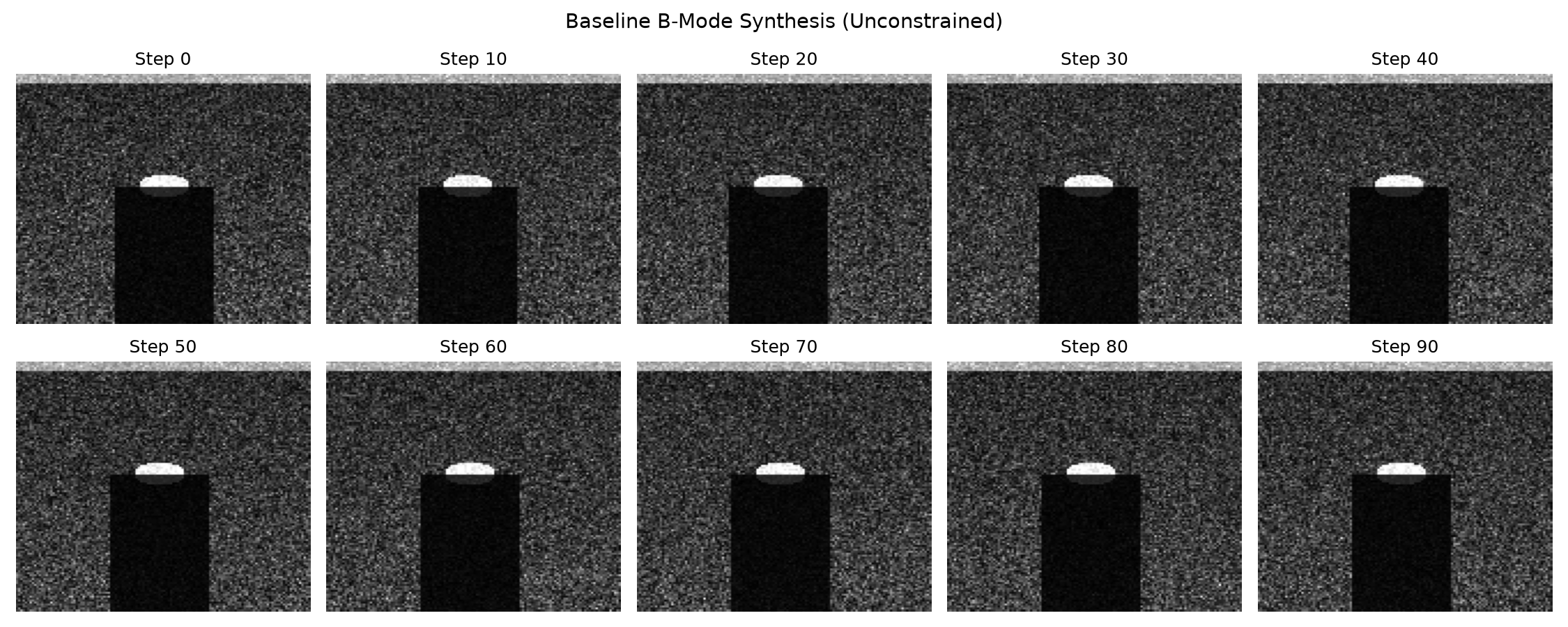 Baseline B-Mode Reconstruction