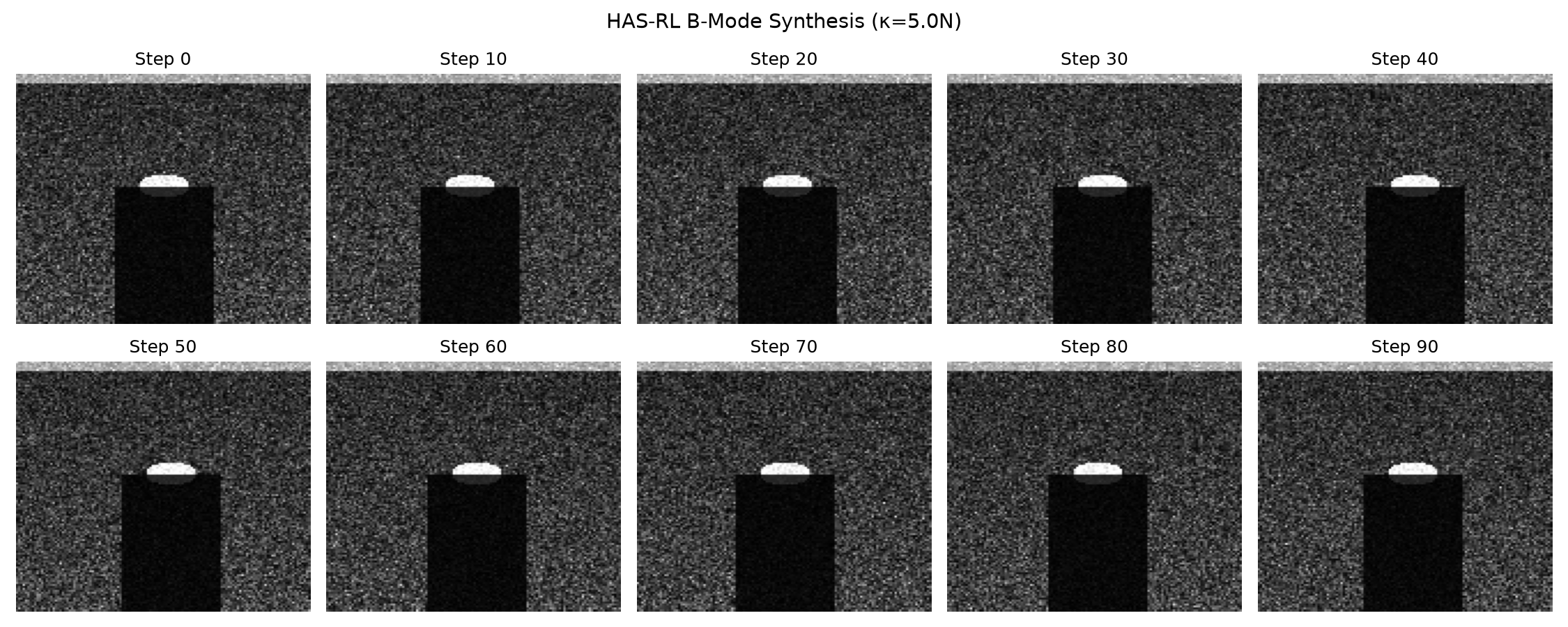 HAS-RL B-Mode Reconstruction